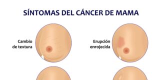 Tres factores que aumentan la probabilidad de padecer cáncer de seno